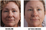 MAKE IT A DOUBLE GROWTH FACTOR SYSTEM