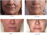 MAKE IT A DOUBLE GROWTH FACTOR SYSTEM